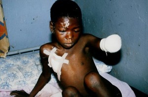 Photo du Génocide de Ntega Marangara au Burundi en 1988 ( Voir collection photo : http://ntega-marangara.populus.org/pix/5 )