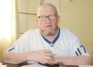Burundi : 1.234 albinos barundi veulent une aide de l'Etat contre le soleil ( Photo : PPBDI.COM 2019 )
